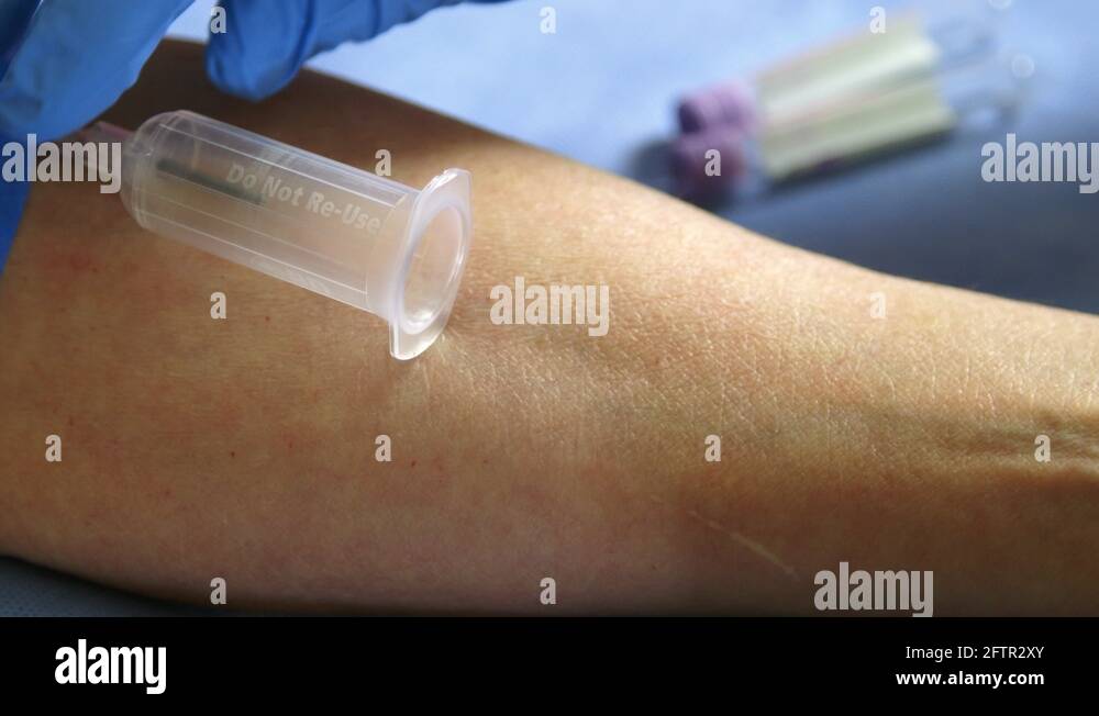 Vacutainer blood collection tube Stock Videos & Footage HD and 4K