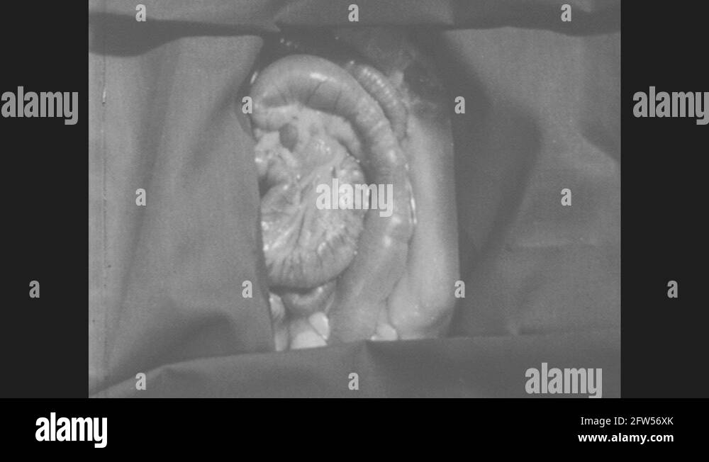 Colon large intestine Stock Videos & Footage HD and 4K Video Clips