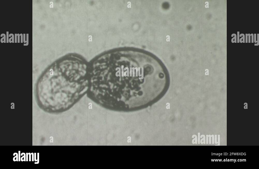 1940s Tapeworm egg under microscope hatches, operculum opens, embryo