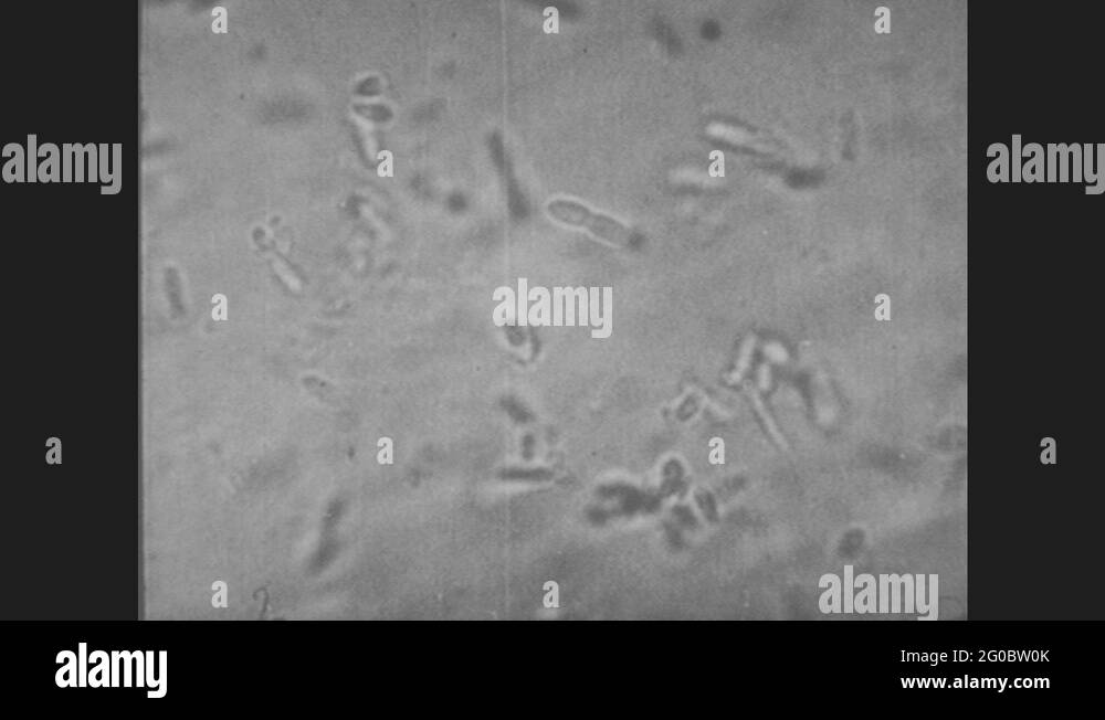 Bacteria skin microscope Stock Videos & Footage HD and 4K Video Clips Alamy
