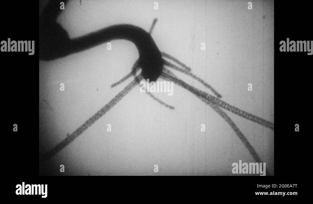 Pond water organisms Stock Videos & Footage - HD and 4K Video Clips - Alamy