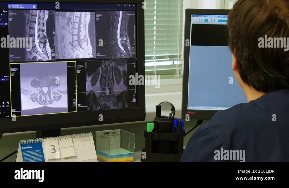 Healthy spinal cord Stock Videos & Footage - HD and 4K Video Clips - Alamy