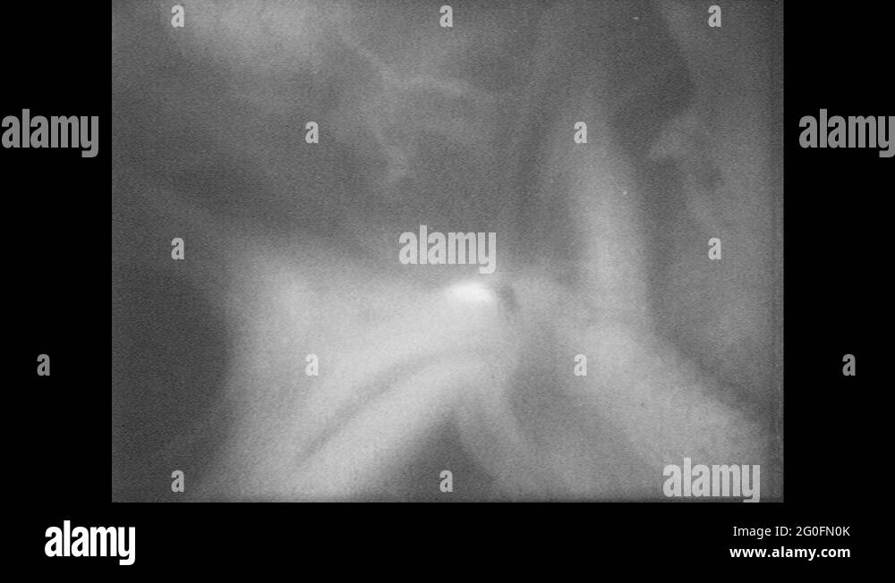 Cross beaks Stock Videos & Footage HD and 4K Video Clips Alamy