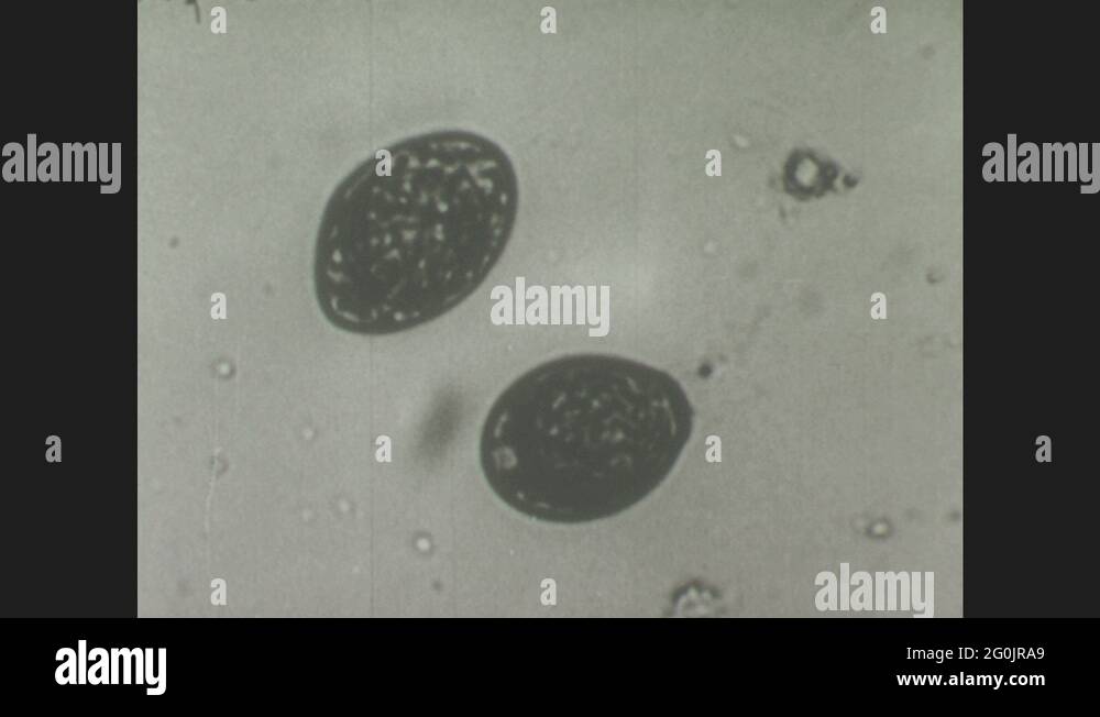 1940s Tapeworm egg under microscope hatches, operculum opens, embryo