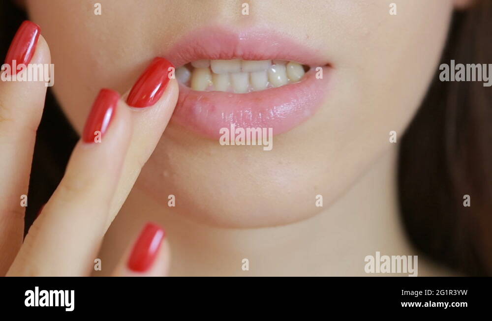 girl touching sores on the lips. herpes. lip treatment, Young plump