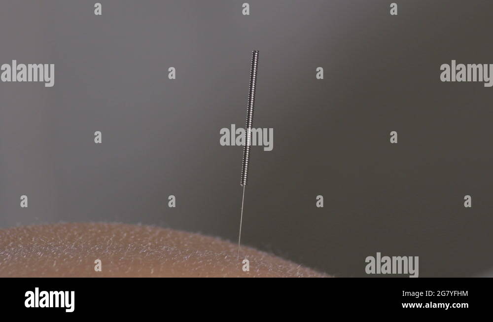 Spike needle Stock Videos & Footage HD and 4K Video Clips Alamy