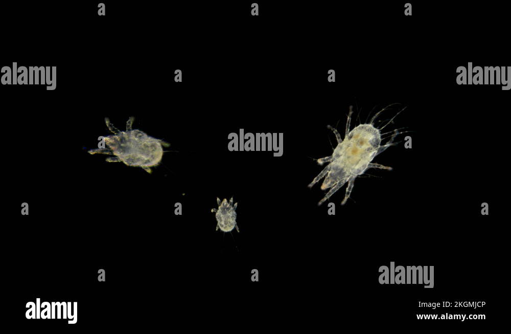 a granary or flour mite under a microscope Stock Video Footage Alamy