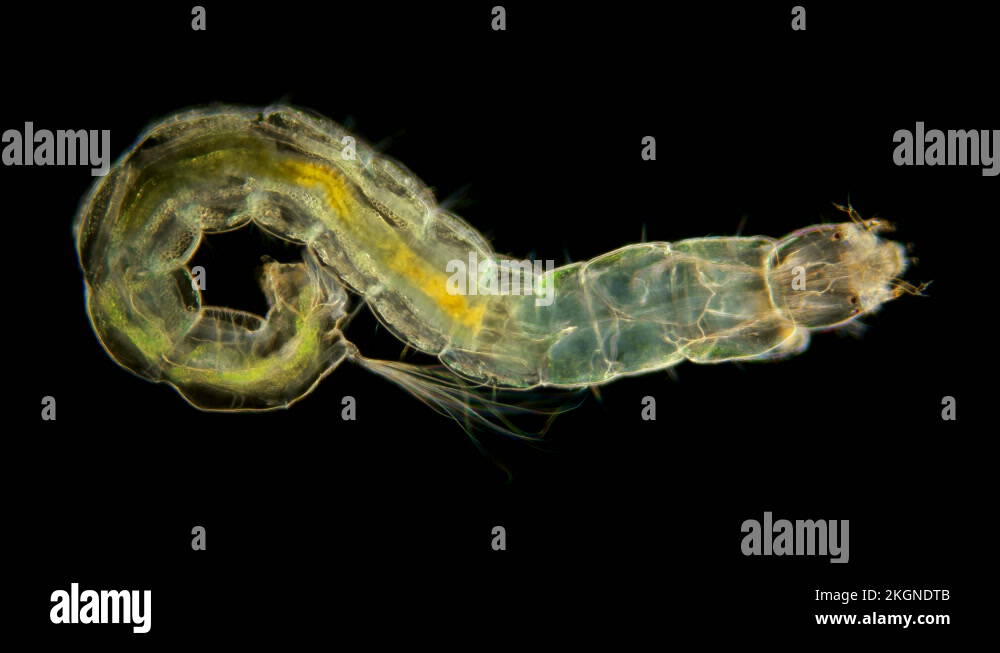 insect larva Chironomidae under the microscope Stock Video Footage - Alamy