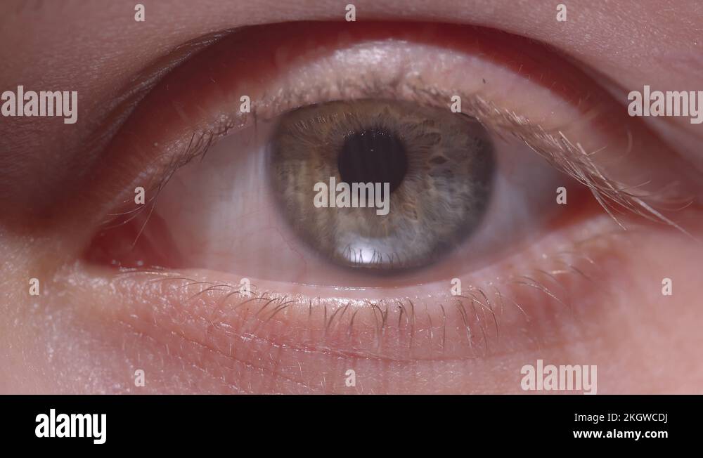 Shrink pupil Stock Videos & Footage HD and 4K Video Clips Alamy