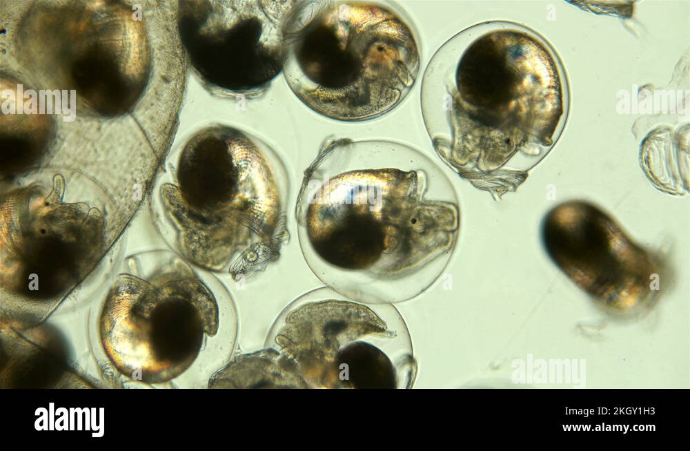 Snail. Snail eggs under the microscope Stock Video Footage Alamy