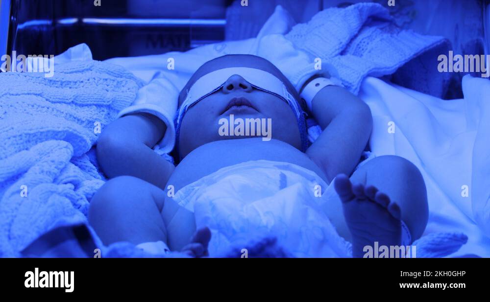 Newborn under jaundice phototherapy treatment Stock Video Footage Alamy