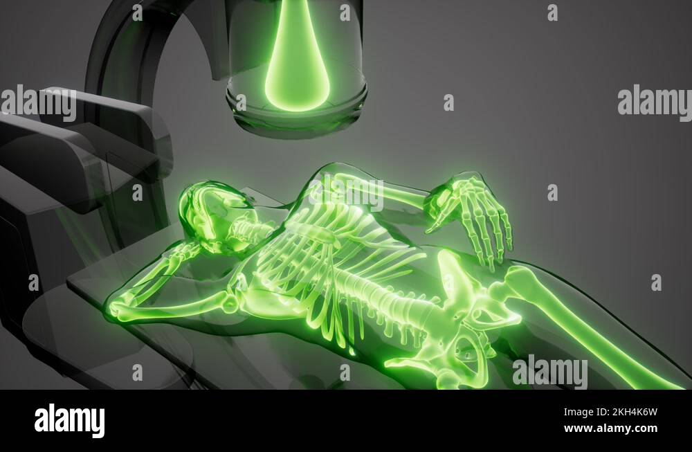 xray examination Medical Scan footage Stock Video Footage Alamy