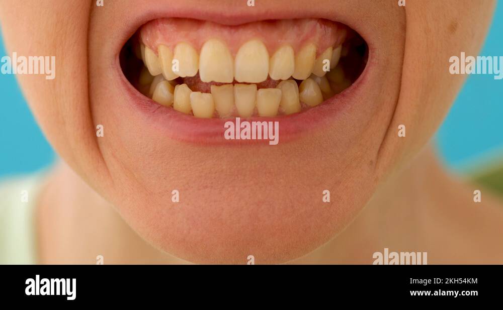 Grit your teeth Stock Videos & Footage HD and 4K Video Clips Alamy