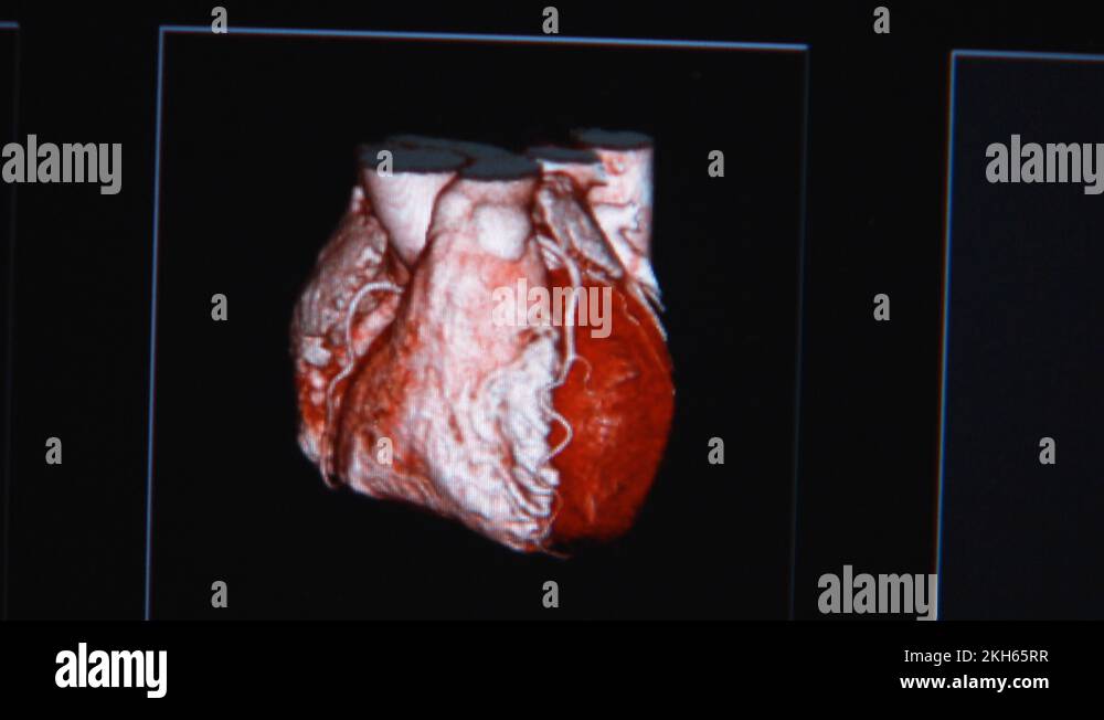 Internal zoom Stock Videos & Footage HD and 4K Video Clips Alamy