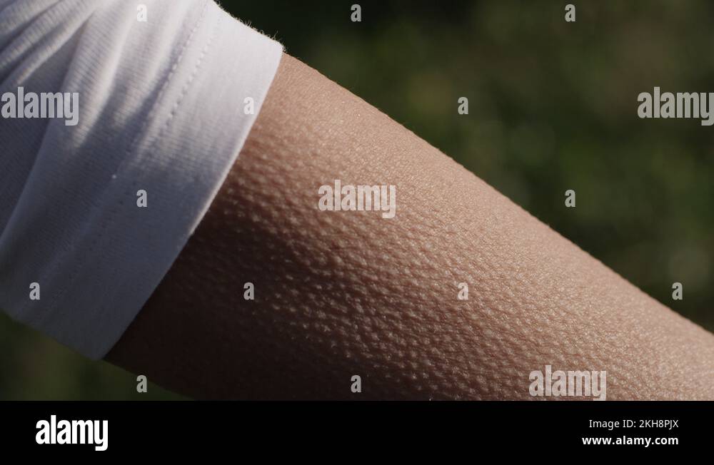 Woman with goose bumps on arm Stock Videos & Footage HD and 4K Video