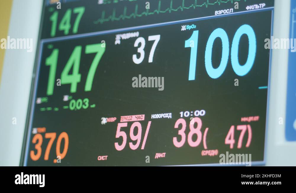 Vital signs display Stock Videos & Footage HD and 4K Video Clips Alamy