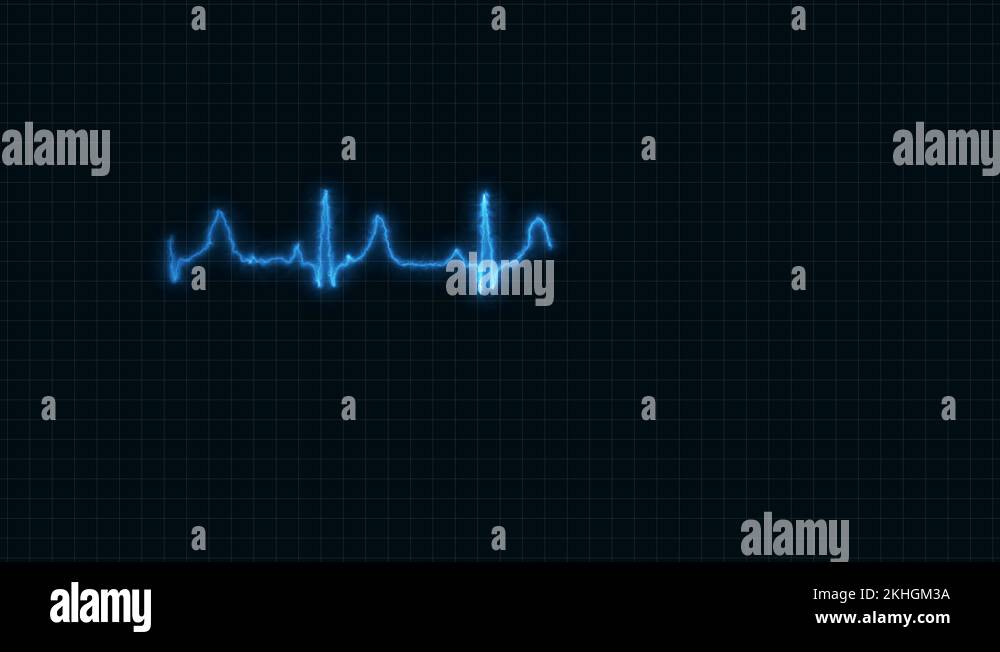 An electrocardiogram heart monitor pulses on a blue grid (Loop Stock