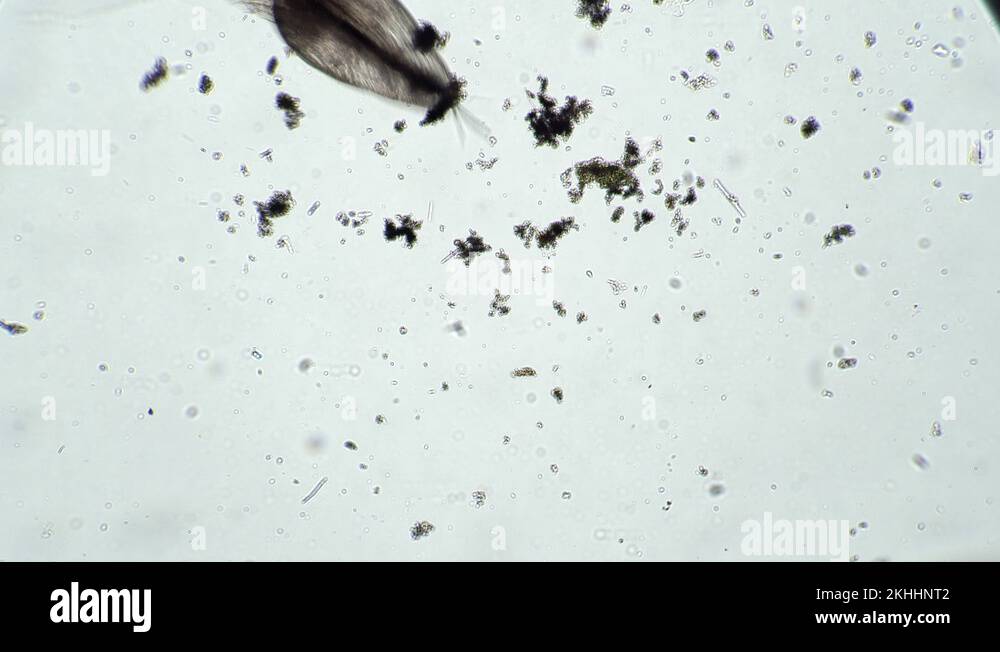 Bacteria microscope pond water Stock Videos & Footage - HD and 4K Video ...