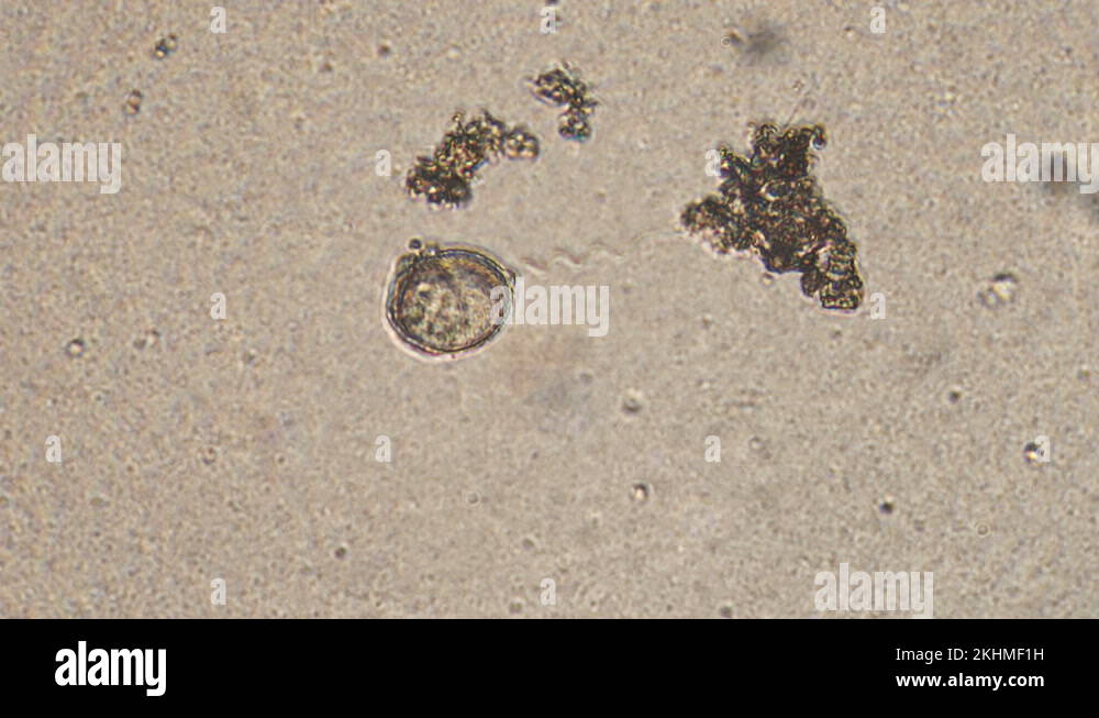 Ciliated protozoa pond water Stock Videos & Footage - HD and 4K Video ...