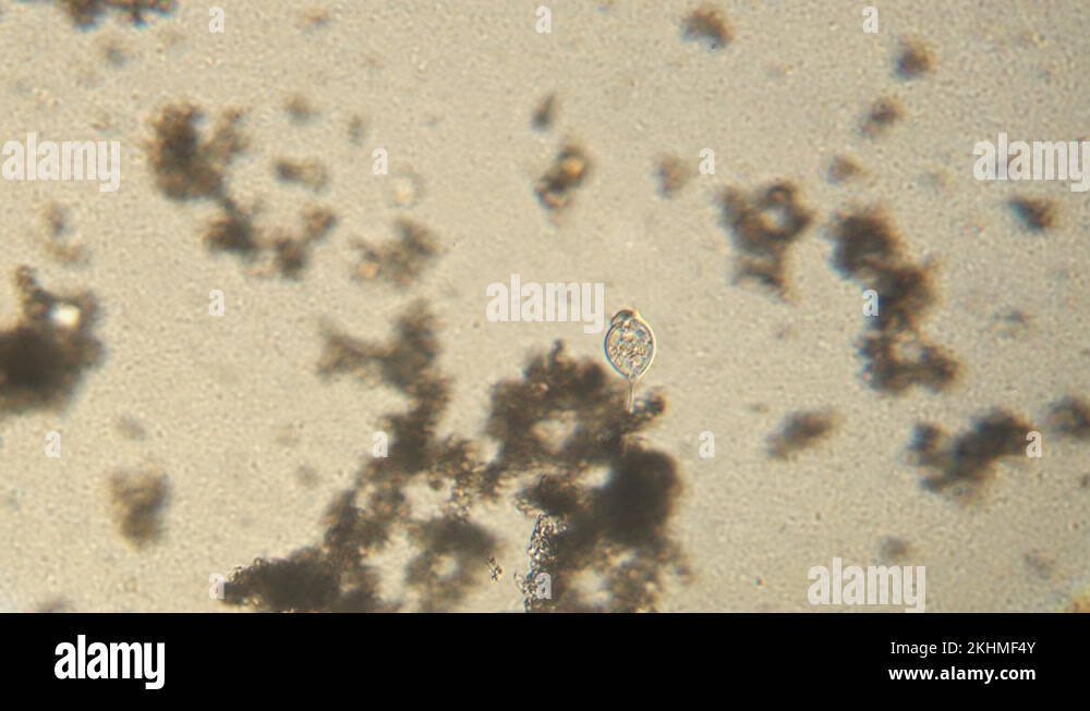 Microscopy of protozoa Vorticella in the water (pond) sample. Infusoria ...