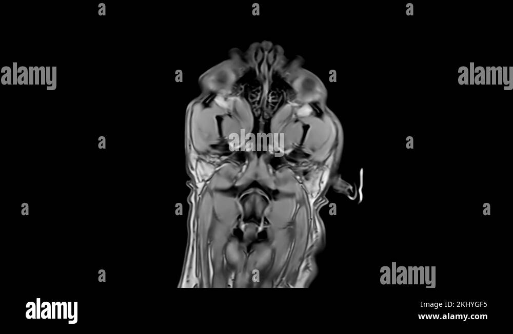 A Tomography Scan of A Dog's Head. Resonance of a dog head