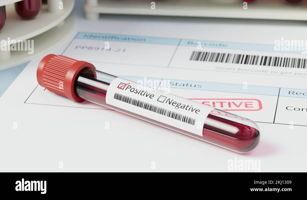 Blood sample with a positive test. Viral infection. Patient documents
