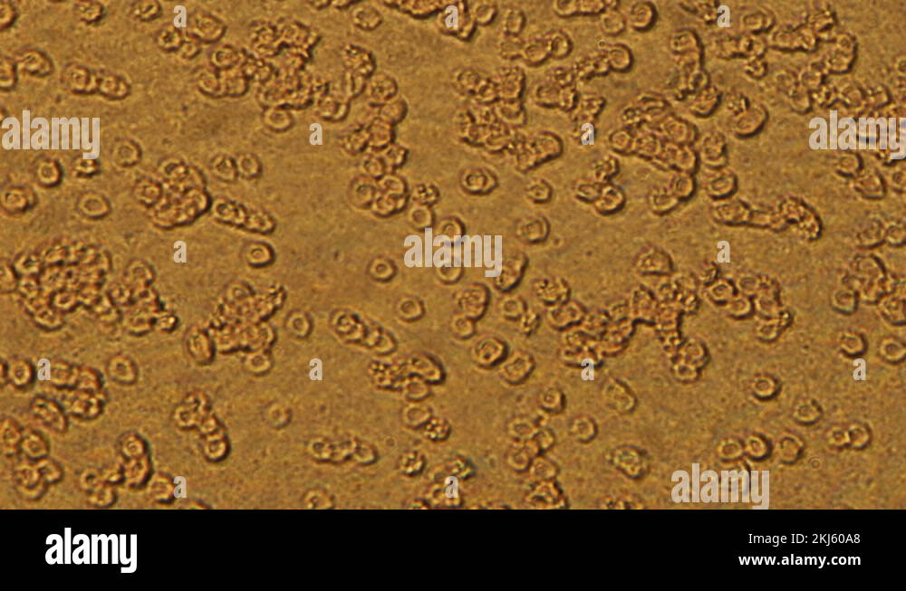 Microscopy of human blood cell test. Magnification 300x moving of red