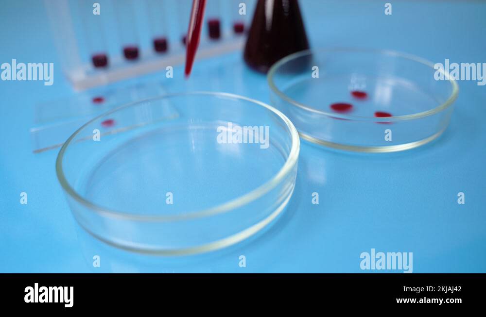 Dripping blood into the Petri dishes. Blood in Microbiology test