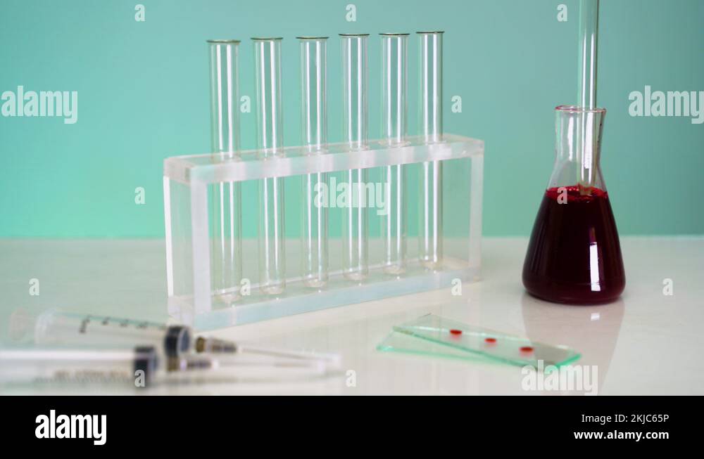 Blood test. Pipette drop of blood into tubes to research. Scientists