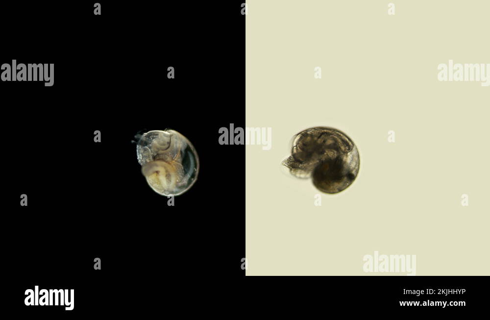 Larva of a sea snail different types under the microscope, called