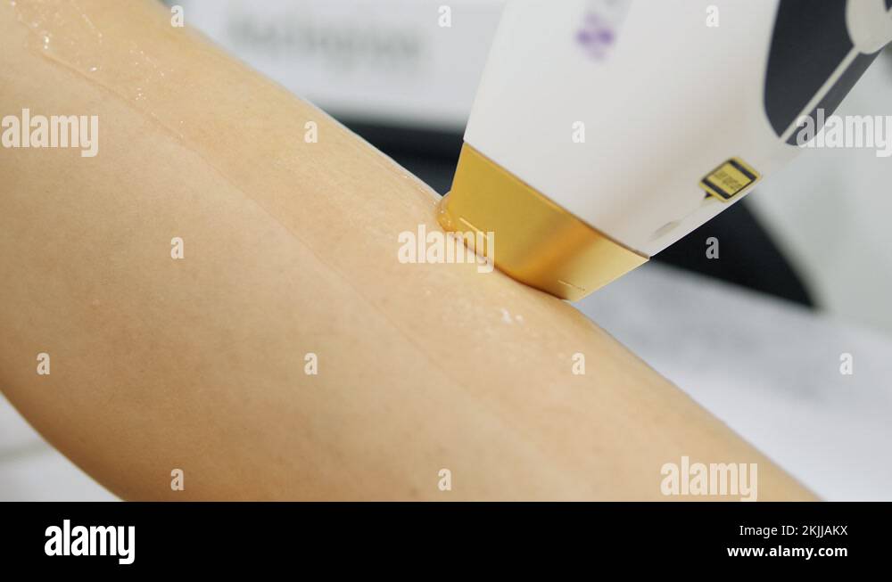 Beautician removes hair on beautiful female legs using a laser. Laser