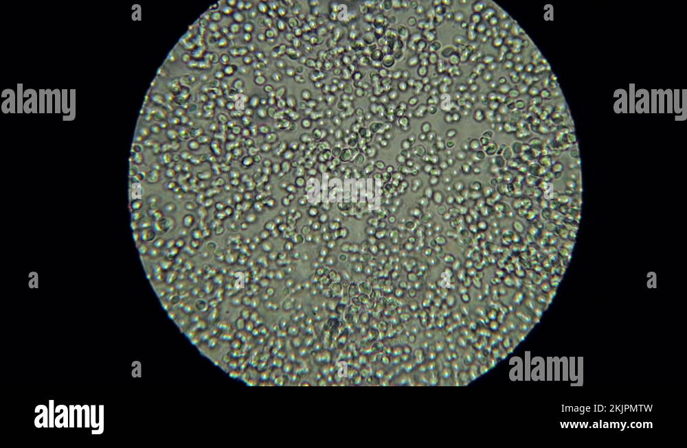Ferment fungi Stock Videos & Footage - HD and 4K Video Clips - Alamy