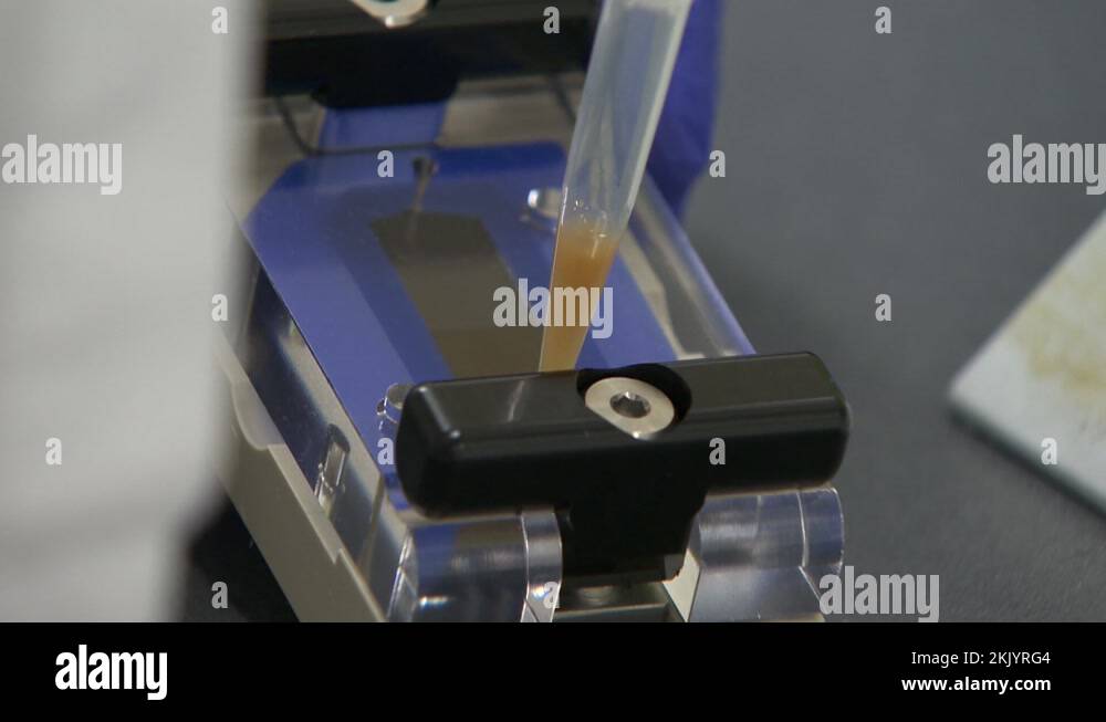 Hiv aids treatment Stock Videos & Footage - HD and 4K Video Clips - Alamy