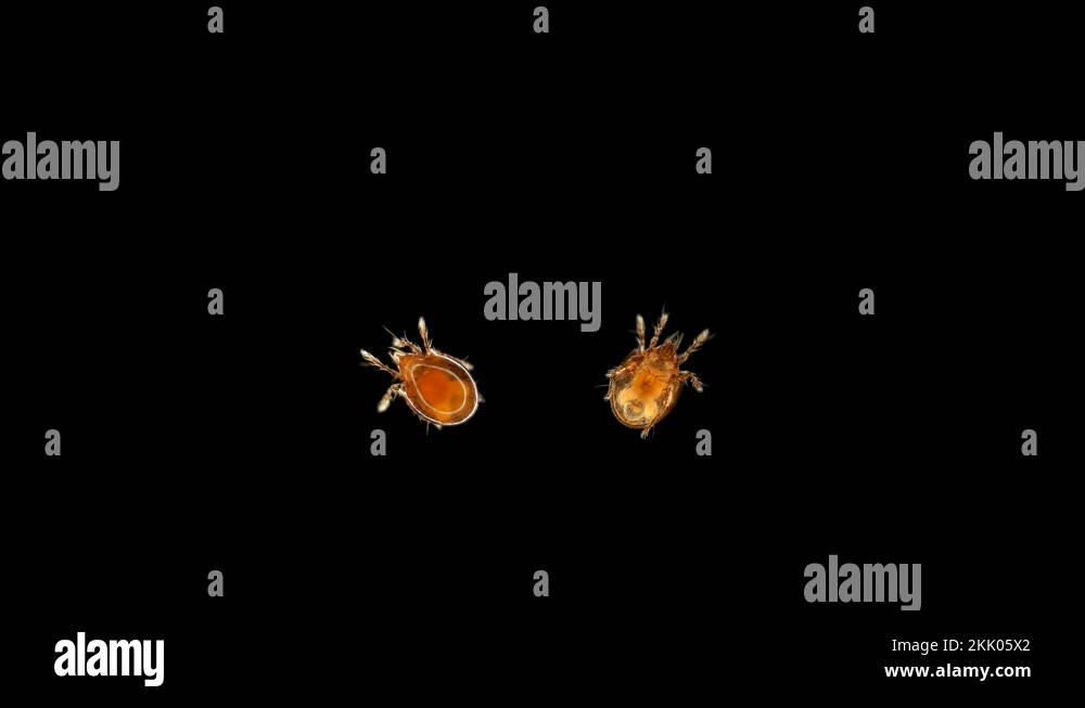 Acari (mite) Oribatida under microscope are saprosphago, order ...