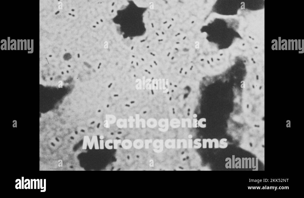 1950s Microscopic organisms. Fungi and protozoa cells under microscope
