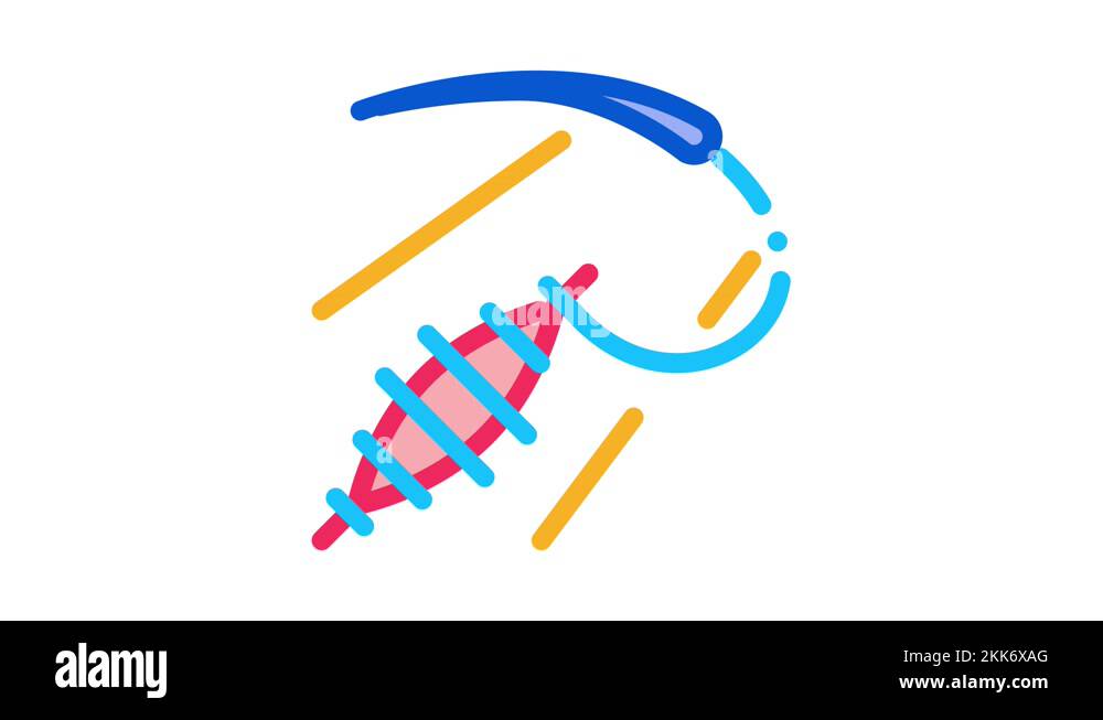 Wound closure Stock Videos & Footage HD and 4K Video Clips Alamy