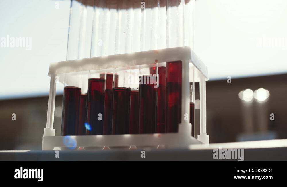 Blood liquid glass Stock Videos & Footage HD and 4K Video Clips Alamy