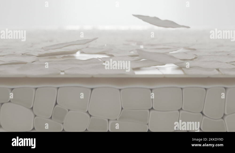 Dead epidermis cells slowly peeling away from the skin surface, macro