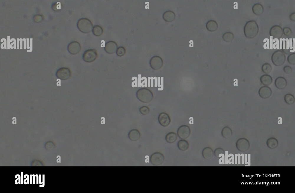 Microscopy of yeast cells (Saccharomyces cerevisiae). Monochrome ...