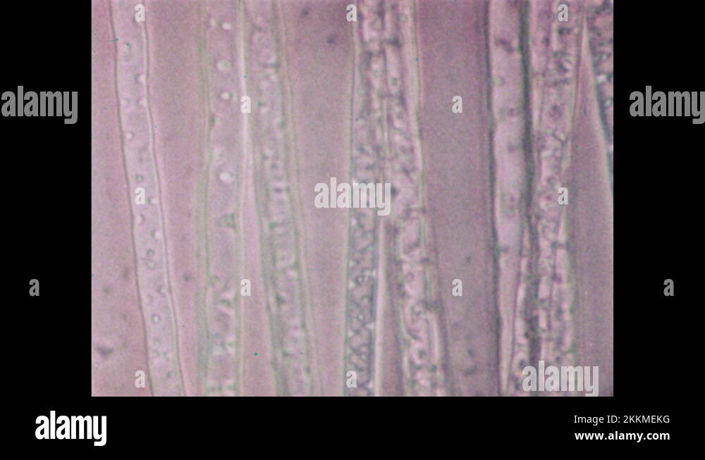 Rizoid Roots 1960s: Rhizoid roots under earth. Magnification of rhizoid roots. Dots ...