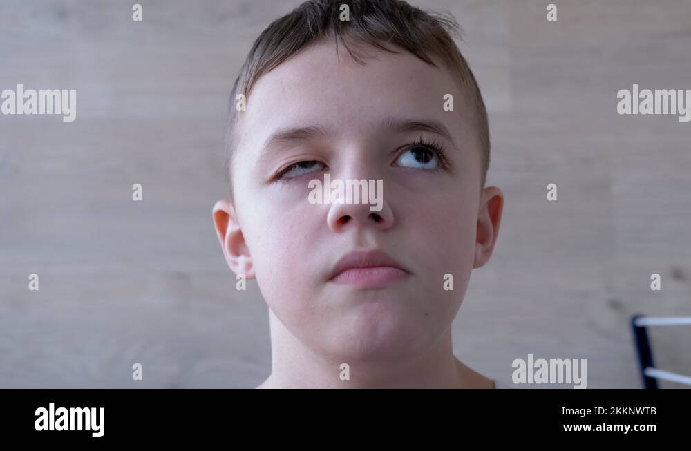 Boy with Drooping Upper of Eyelid, Long Lashes. Myopia. Pupil Rotation