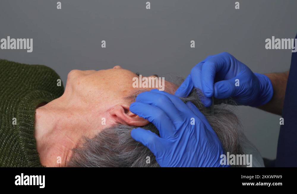 Physical therapy session, using the Dry Needling technique, for a Stock