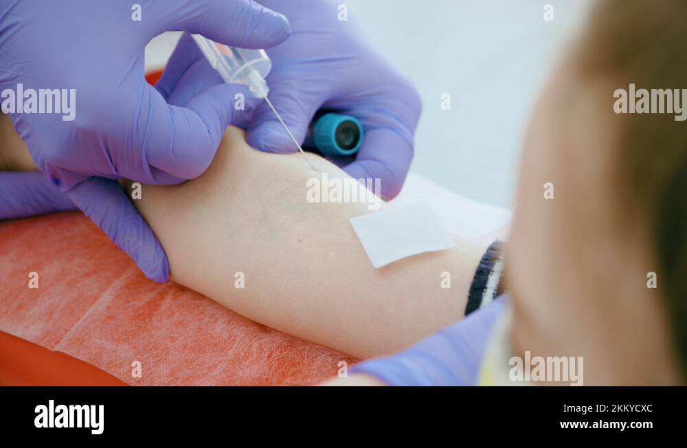 Syringe needle pierces patient skin in hospital lab to draw blood from