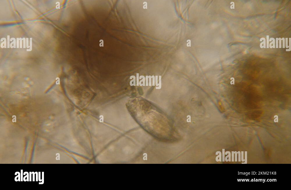 Bacteria Parasites and Worms in drinking Water under Microscope