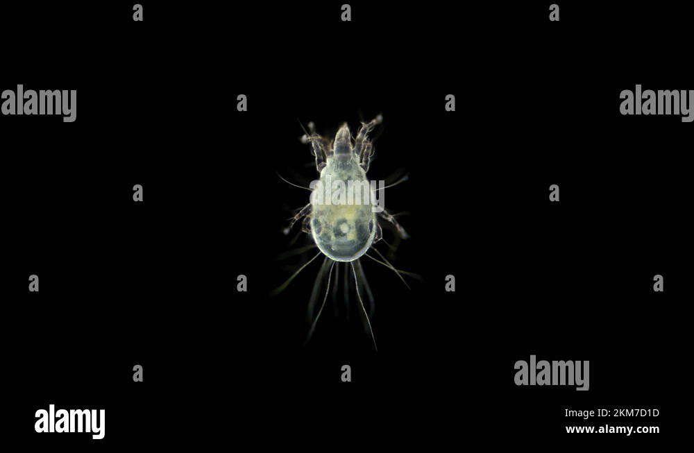 Shockingly Large Actual Size Images Of Flour Mites In Your Pantry - ejglsn1