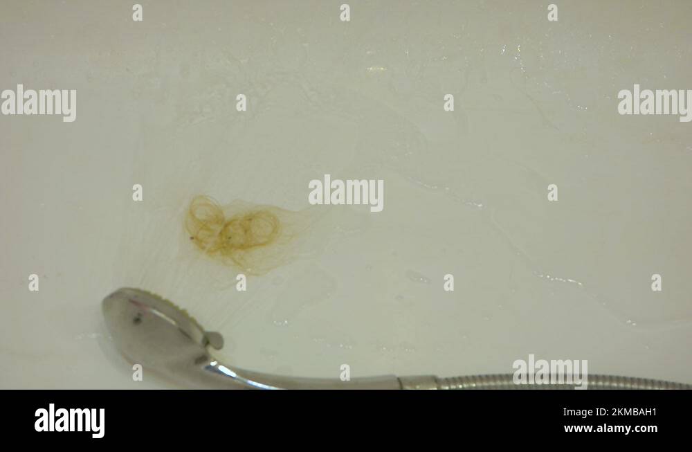 The acute problem of hair loss in women is a topic. The shower head in