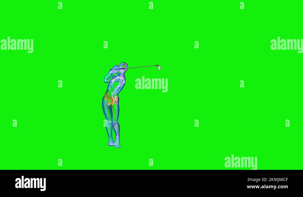 Athlete XRay Hitting A Golf Ball, Zoom In, Green Screen Chromakey