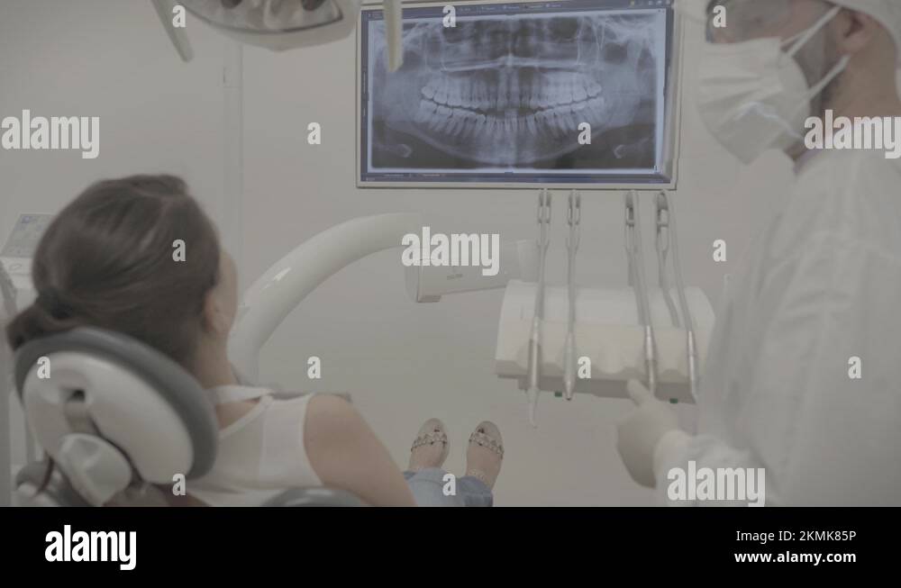 Dental xray scan on viewer Stock Videos & Footage HD and 4K Video