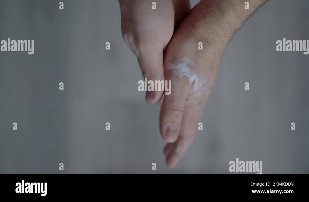 Hands Spreading And Applying Medication Cream On Dry Itchy Skin. close