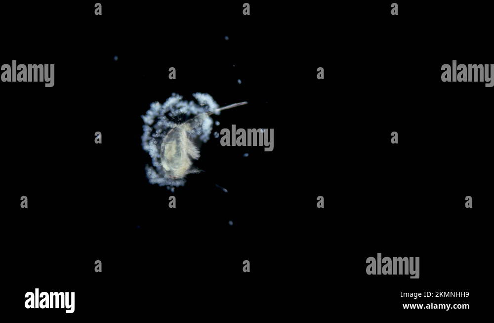 Crustacea Copepoda and ciliate Vorticella under microscope Stock Video ...
